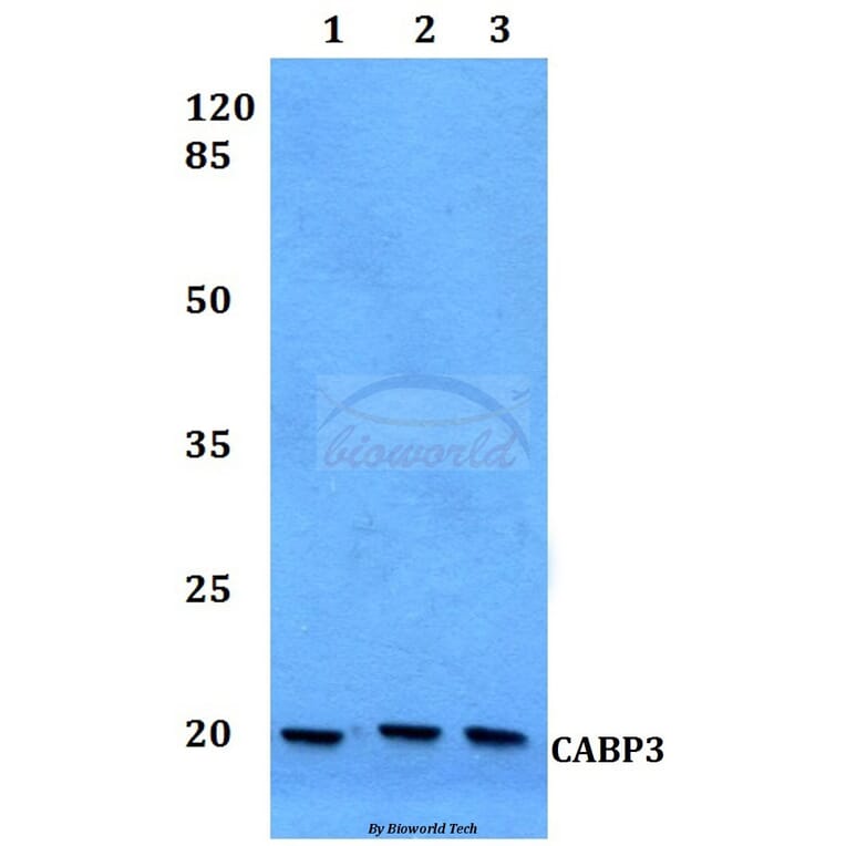Anti-CABP3 Antibody from Bioworld Technology (BS60125) - Antibodies.com