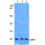 Anti-CABP3 Antibody from Bioworld Technology (BS60125) - Antibodies.com