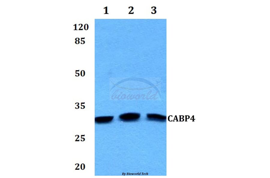 Anti-CABP4 Antibody from Bioworld Technology (BS60126) - Antibodies.com