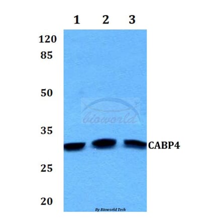 Anti-CABP4 Antibody from Bioworld Technology (BS60126) - Antibodies.com