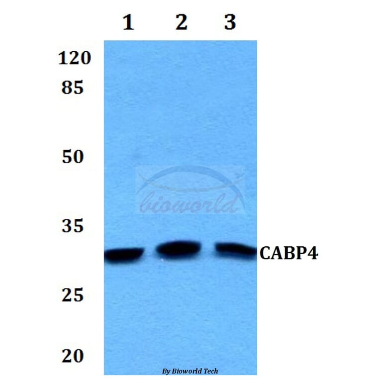 Anti-CABP4 Antibody from Bioworld Technology (BS60126) - Antibodies.com