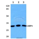 Anti-CABP4 Antibody from Bioworld Technology (BS60126) - Antibodies.com