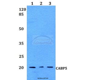 Anti-CABP5 Antibody from Bioworld Technology (BS60127) - Antibodies.com