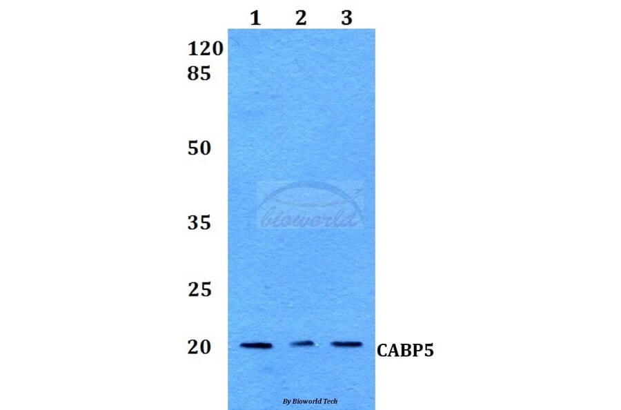 Anti-CABP5 Antibody from Bioworld Technology (BS60127) - Antibodies.com