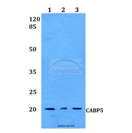 Anti-CABP5 Antibody from Bioworld Technology (BS60127) - Antibodies.com