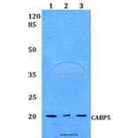 Anti-CABP5 Antibody from Bioworld Technology (BS60127) - Antibodies.com