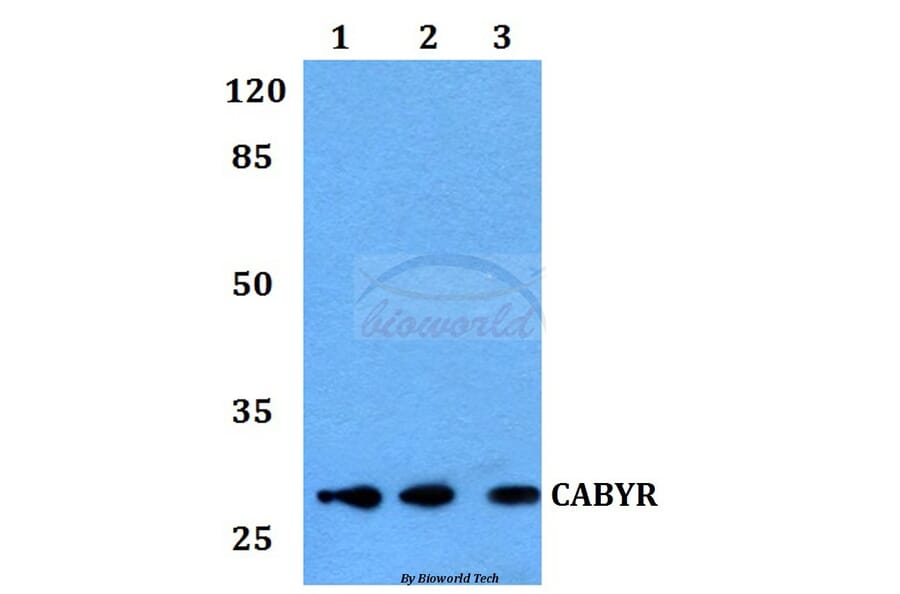 Anti-CABYR Antibody from Bioworld Technology (BS60128) - Antibodies.com