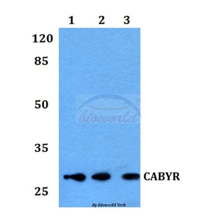 Anti-CABYR Antibody from Bioworld Technology (BS60128) - Antibodies.com