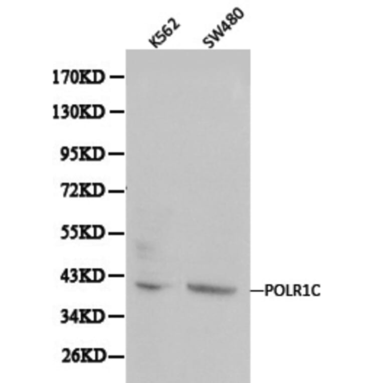 Anti-POLR1C Antibody from Bioworld Technology (BS6014) - Antibodies.com