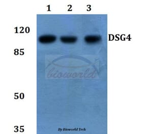 Anti-Desmoglein 4 Antibody from Bioworld Technology (BS60141) - Antibodies.com