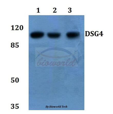 Anti-Desmoglein 4 Antibody from Bioworld Technology (BS60141) - Antibodies.com