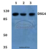Anti-Desmoglein 4 Antibody from Bioworld Technology (BS60141) - Antibodies.com