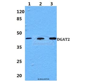 Anti-DGAT2 Antibody from Bioworld Technology (BS60142) - Antibodies.com