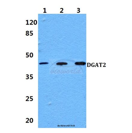 Anti-DGAT2 Antibody from Bioworld Technology (BS60142) - Antibodies.com
