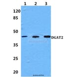 Anti-DGAT2 Antibody from Bioworld Technology (BS60142) - Antibodies.com