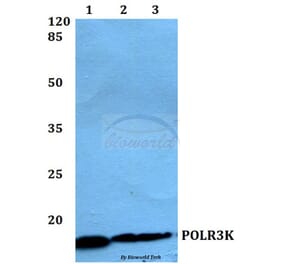 Anti-POLR3K Antibody from Bioworld Technology (BS60146) - Antibodies.com