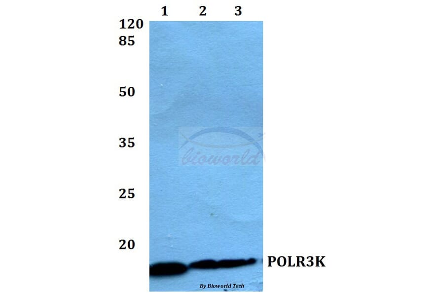 Anti-POLR3K Antibody from Bioworld Technology (BS60146) - Antibodies.com