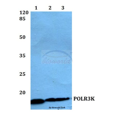 Anti-POLR3K Antibody from Bioworld Technology (BS60146) - Antibodies.com