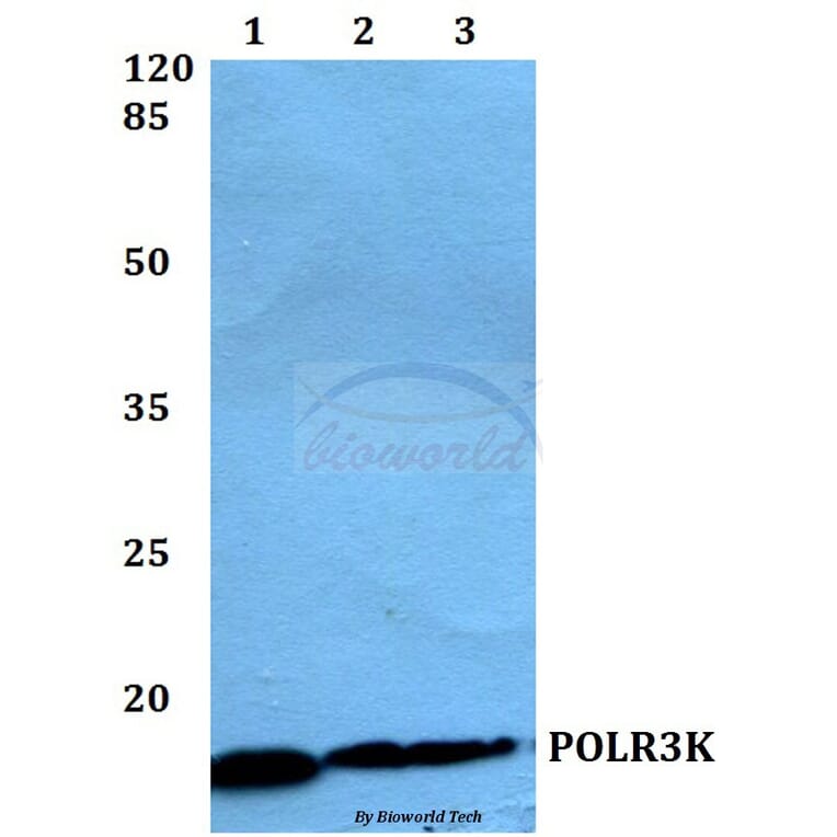 Anti-POLR3K Antibody from Bioworld Technology (BS60146) - Antibodies.com