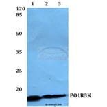 Anti-POLR3K Antibody from Bioworld Technology (BS60146) - Antibodies.com