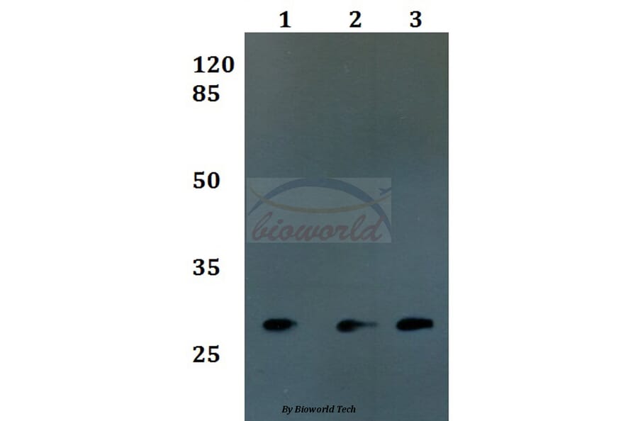 Anti-FOLR3 Antibody from Bioworld Technology (BS60155) - Antibodies.com