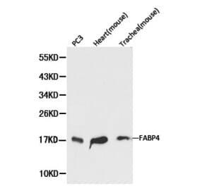 Anti-FABP4 Antibody from Bioworld Technology (BS6016) - Antibodies.com