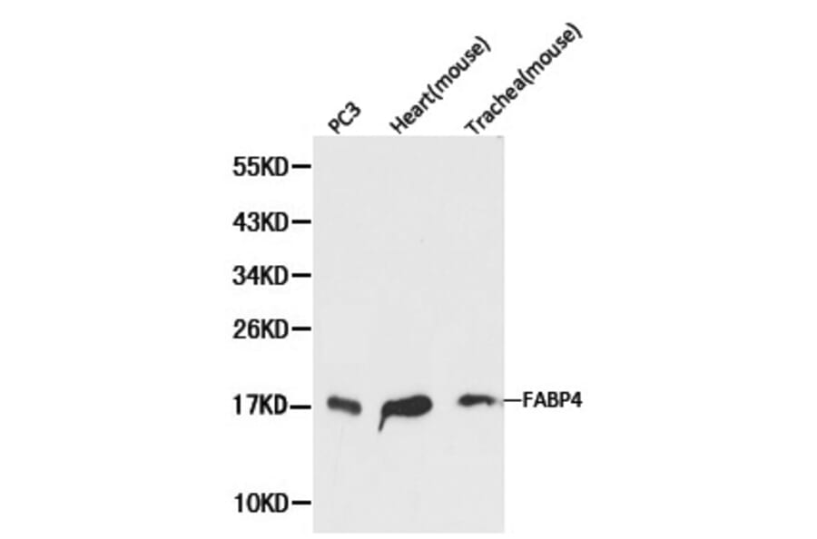 Anti-FABP4 Antibody from Bioworld Technology (BS6016) - Antibodies.com