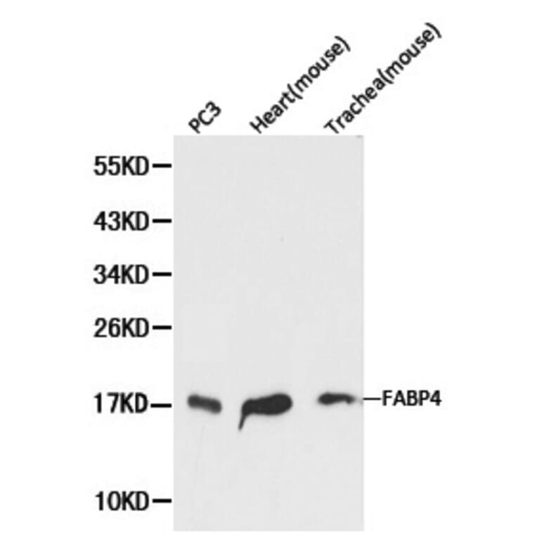 Anti-FABP4 Antibody from Bioworld Technology (BS6016) - Antibodies.com