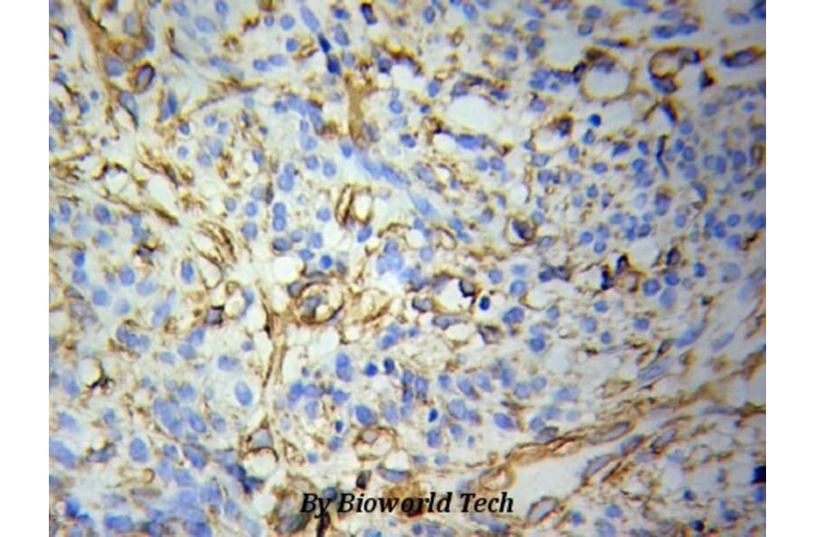 Anti-FABP4 Antibody from Bioworld Technology (BS6016) - Antibodies.com