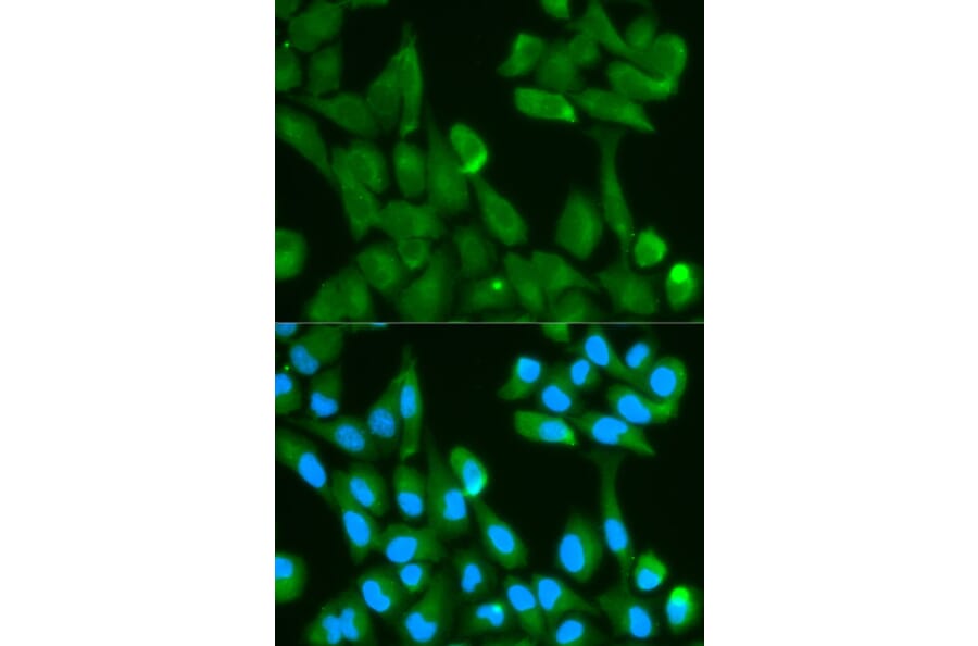 Anti-FABP4 Antibody from Bioworld Technology (BS6016) - Antibodies.com