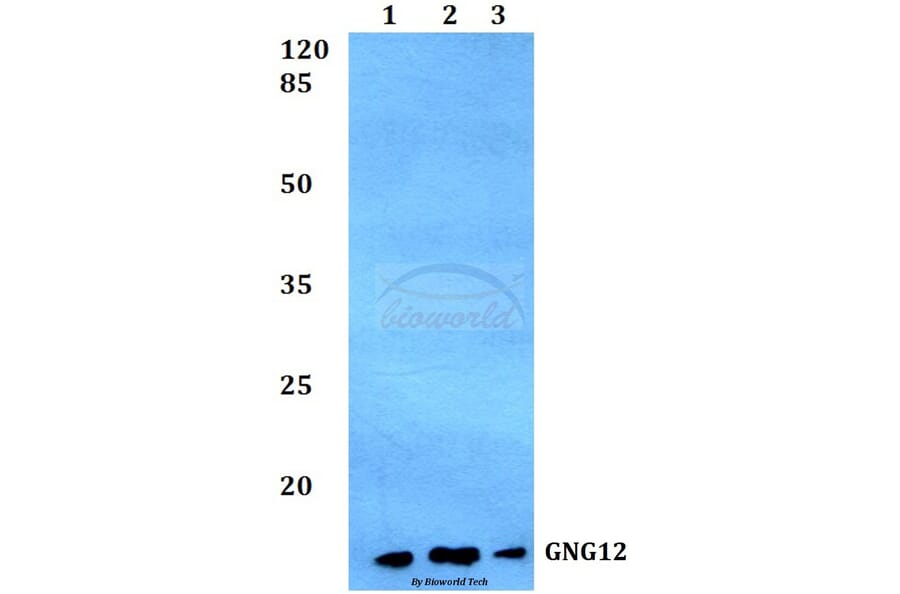 Anti-GNG12 Antibody from Bioworld Technology (BS60161) - Antibodies.com