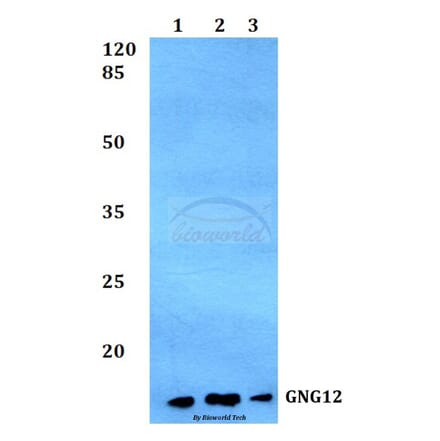 Anti-GNG12 Antibody from Bioworld Technology (BS60161) - Antibodies.com