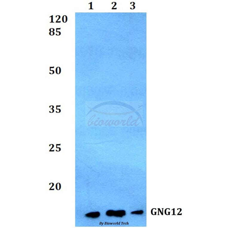 Anti-GNG12 Antibody from Bioworld Technology (BS60161) - Antibodies.com