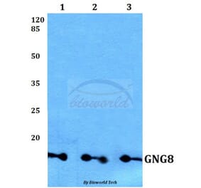 Anti-GNG8 Antibody from Bioworld Technology (BS60162) - Antibodies.com