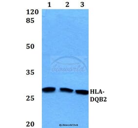 Anti-HLA-DQB2 Antibody from Bioworld Technology (BS60163) - Antibodies.com