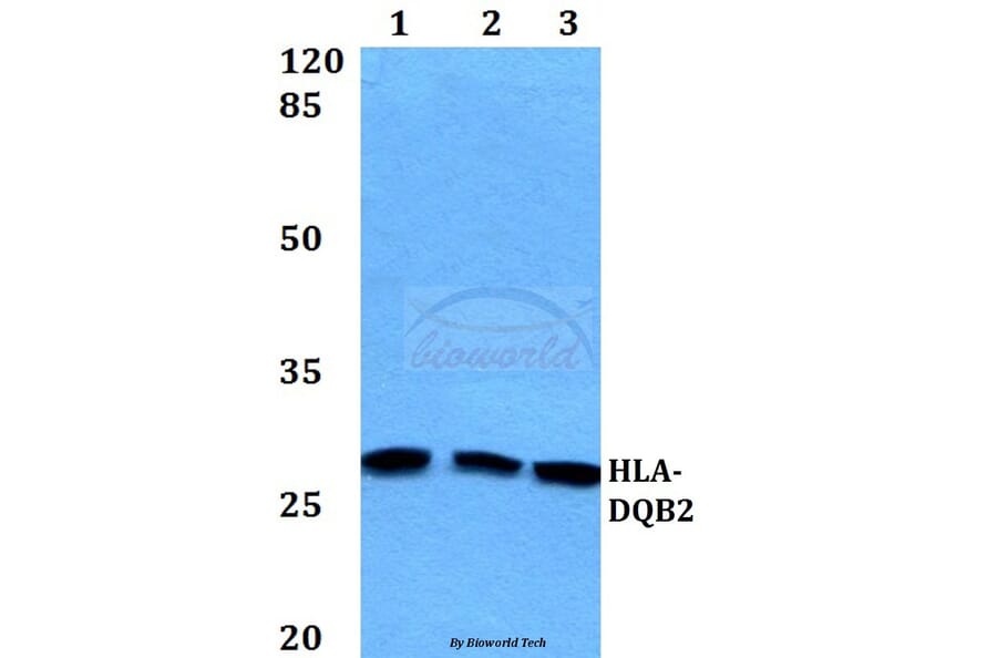 Anti-HLA-DQB2 Antibody from Bioworld Technology (BS60163) - Antibodies.com