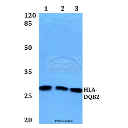 Anti-HLA-DQB2 Antibody from Bioworld Technology (BS60163) - Antibodies.com