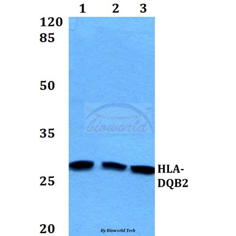 Anti-HLA-DQB2 Antibody from Bioworld Technology (BS60163) - Antibodies.com