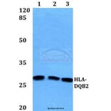 Anti-HLA-DQB2 Antibody from Bioworld Technology (BS60163) - Antibodies.com