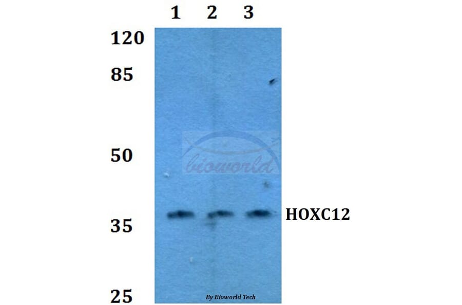 Anti-HOX-C12 Antibody from Bioworld Technology (BS60164) - Antibodies.com