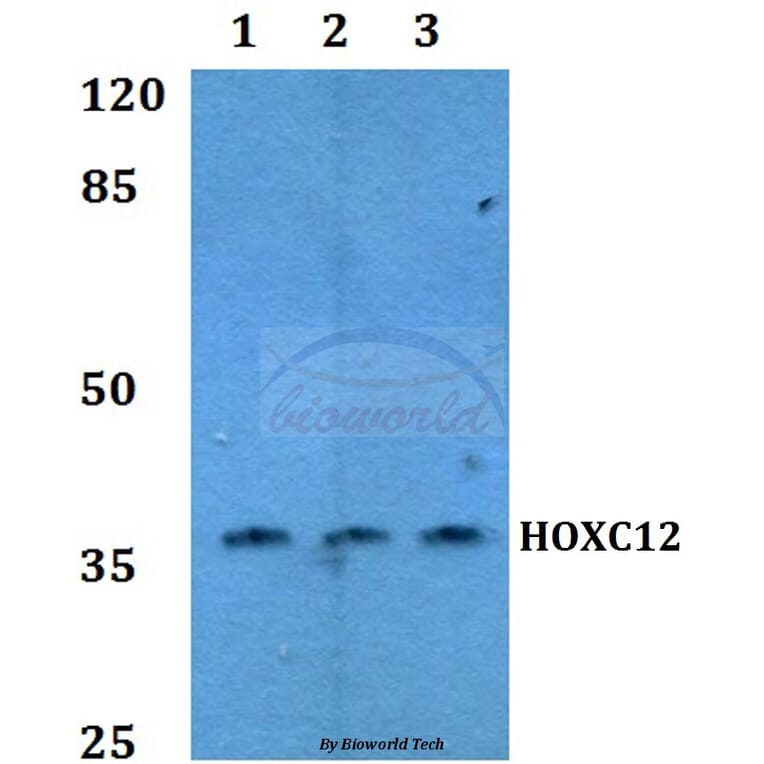 Anti-HOX-C12 Antibody from Bioworld Technology (BS60164) - Antibodies.com