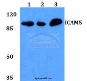 Anti-ICAM-5 Antibody from Bioworld Technology (BS60166) - Antibodies.com