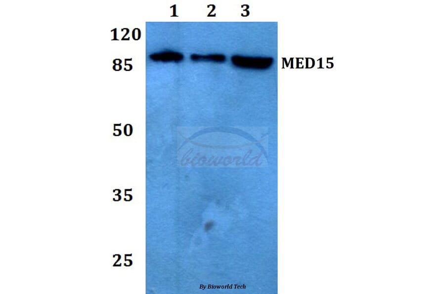 Anti-MED15 Antibody from Bioworld Technology (BS60172) - Antibodies.com