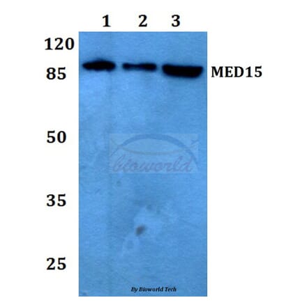 Anti-MED15 Antibody from Bioworld Technology (BS60172) - Antibodies.com