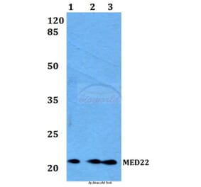 Anti-MED22 Antibody from Bioworld Technology (BS60173) - Antibodies.com