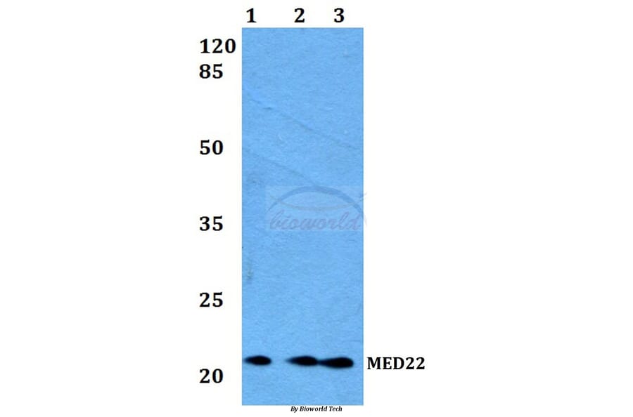 Anti-MED22 Antibody from Bioworld Technology (BS60173) - Antibodies.com