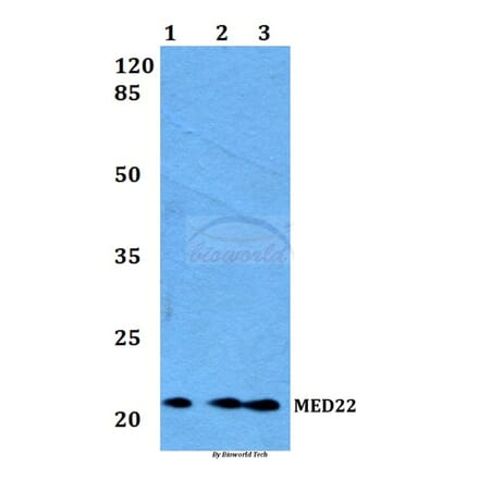 Anti-MED22 Antibody from Bioworld Technology (BS60173) - Antibodies.com