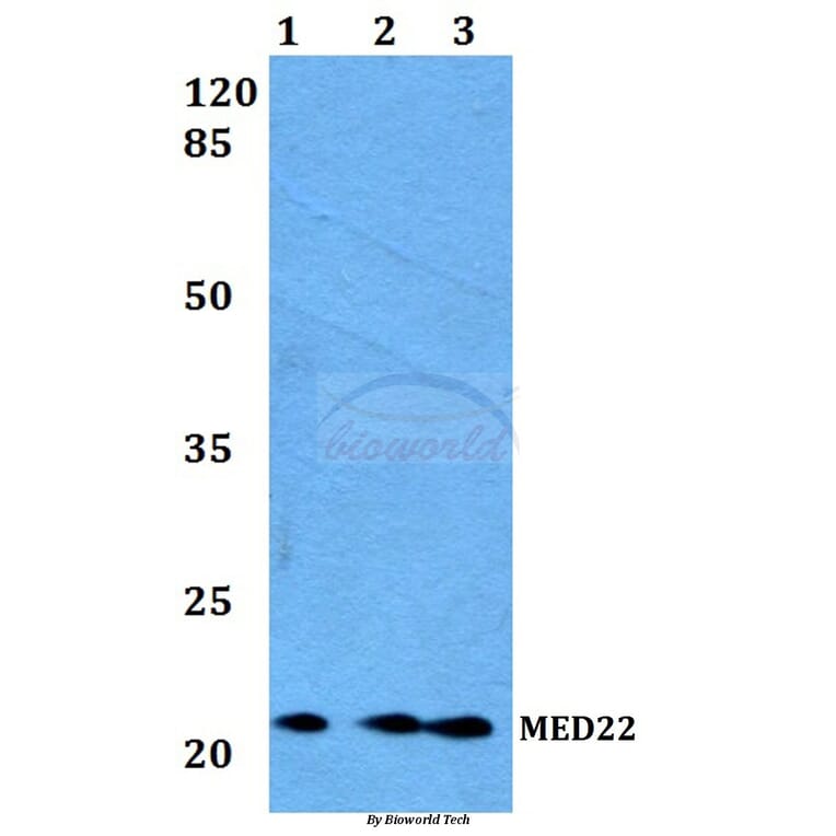 Anti-MED22 Antibody from Bioworld Technology (BS60173) - Antibodies.com
