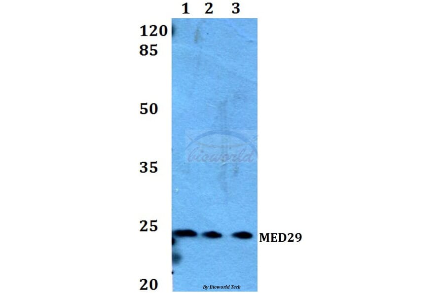 Anti-MED29 Antibody from Bioworld Technology (BS60174) - Antibodies.com