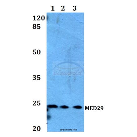 Anti-MED29 Antibody from Bioworld Technology (BS60174) - Antibodies.com